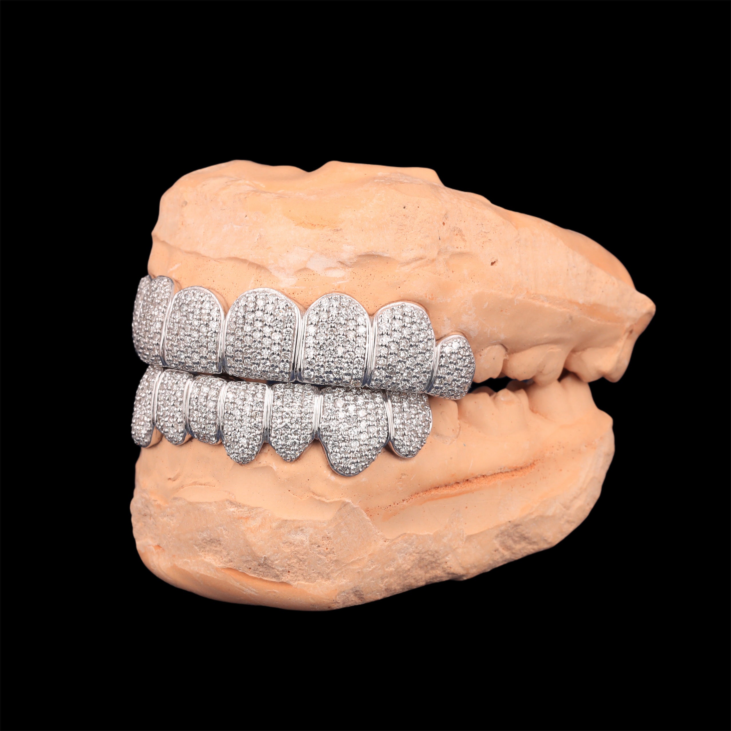11ct VVS GRILLZ FULL SET
