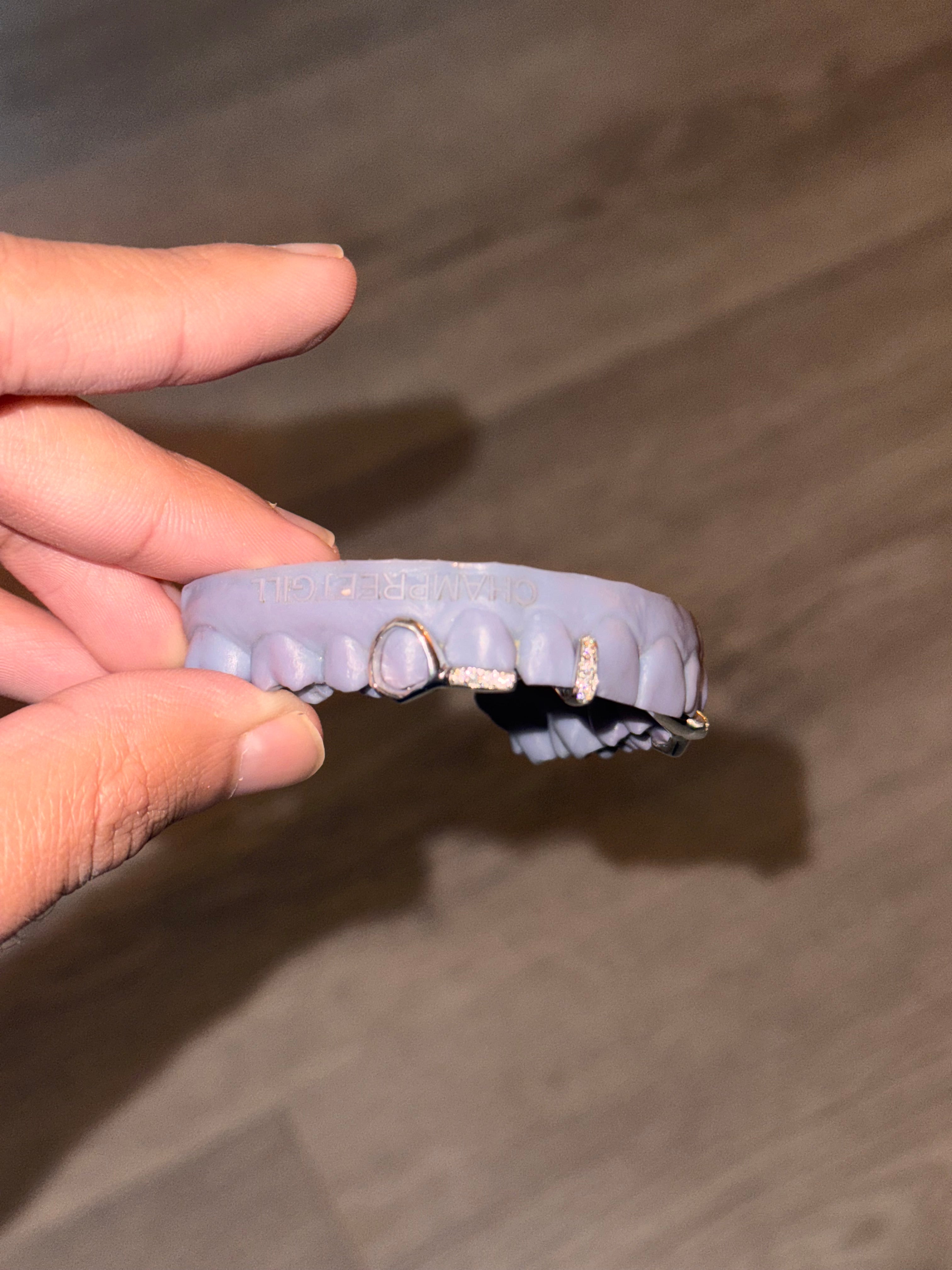 Custom grillz